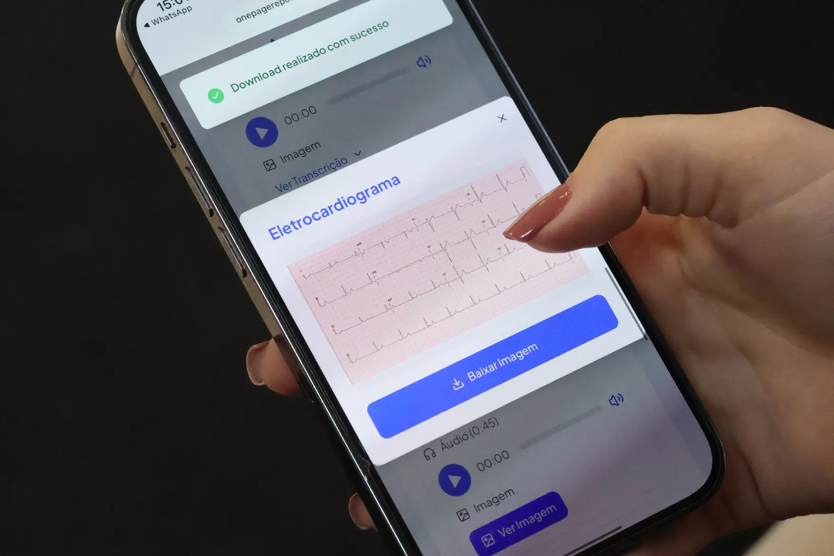 Paciente com o relatório aberto no celular, baixando a imagem do eletrocardiograma; um aviso na tela confirma que o download foi concluído
